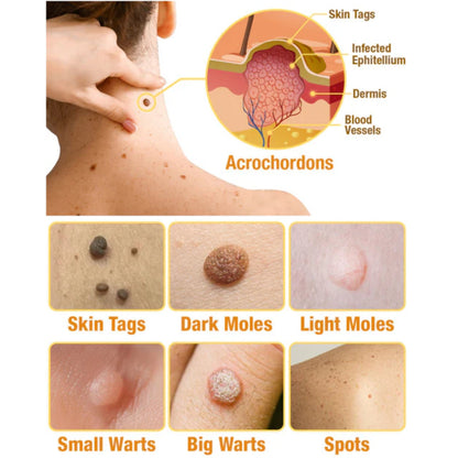 🐝LOVILDS TagRecede Bee Venom Treatment Spray