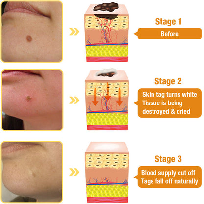 Tag Recede Bee Venom Treatment Spray