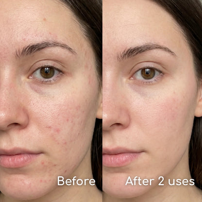 One patch. Whole face.